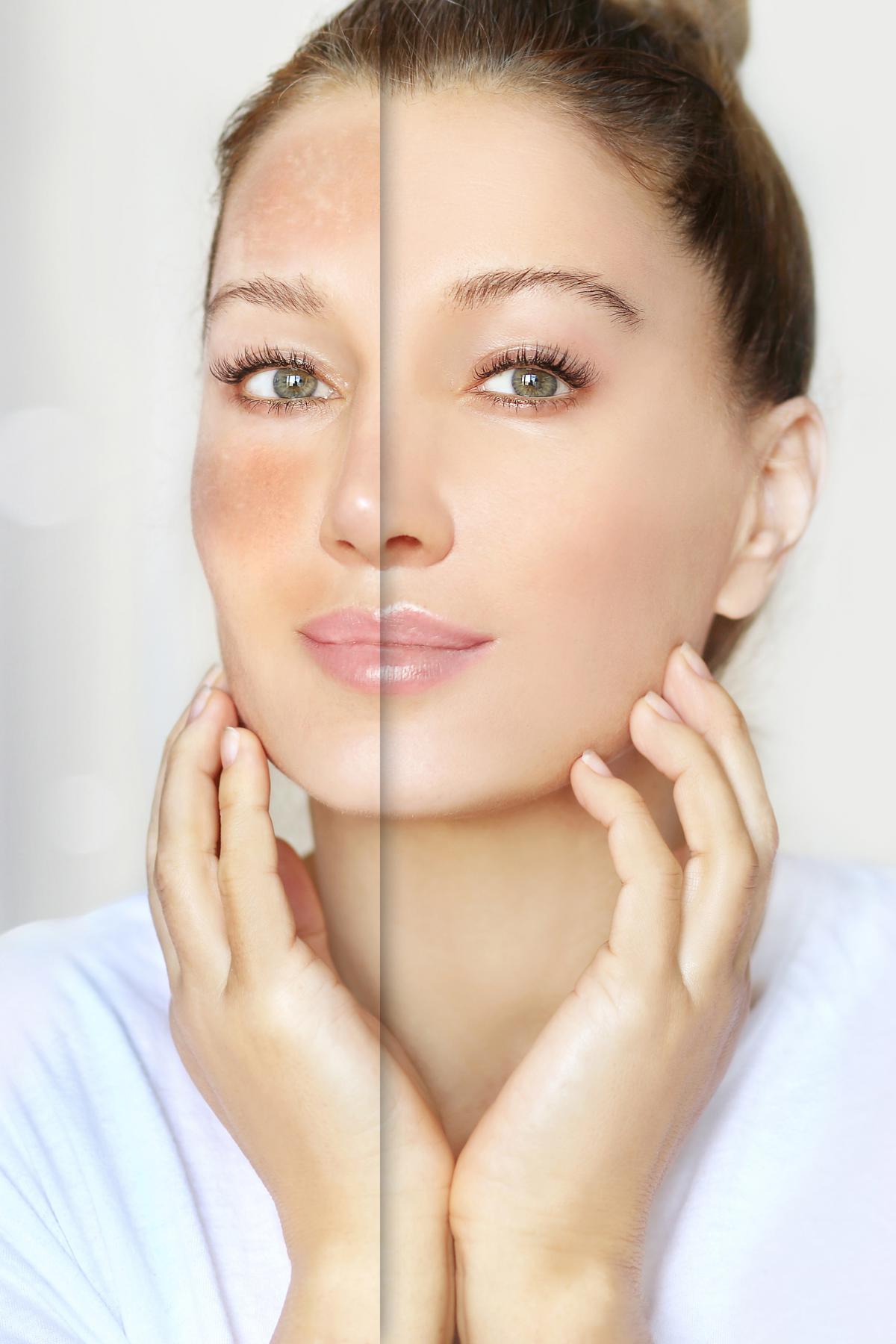 Advanced Skin Brightening Facial at Conceited Beauty Bar, Lancaster, PA.